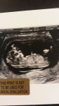 The first picture of our unborn child.